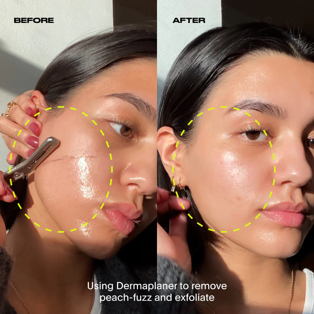 Dermaplaner - Image 7
